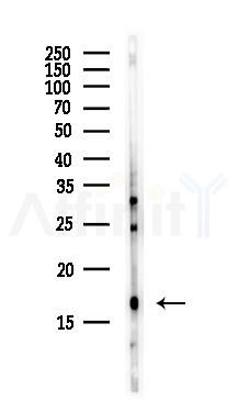 Histone H3 Antibody - Western blot analysis of lysates from EC304 cells(heat-shock,45min treatment), using Histone H3 Antibody at 1/1000 dilution.