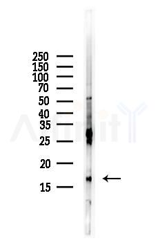 Histone H3 Antibody - Western blot analysis of lysates from HUVEC cells(starvation,24h treatment), using Histone H3 Antibody at 1/1000 dilution.