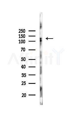 ZEB2 Antibody - Western blot analysis of lysates from PC12 cells, using ZEB2 Antibody at 1/1000 dilution.