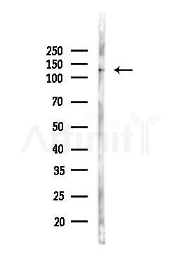 ZEB2 Antibody - Western blot analysis of lysates from Mouse liver, using ZEB2 Antibody at 1/1000 dilution.