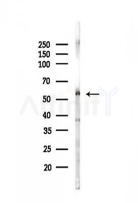 Cytokeratin 18 Antibody - Western blot analysis of lysates from Mouse liver, using Cytokeratin 18 Antibody at 1/1000 dilution.