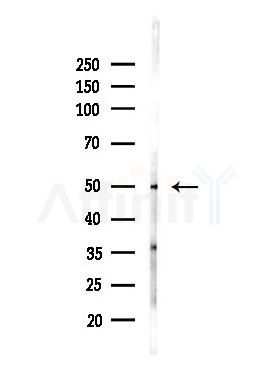 Cytokeratin 18 Antibody - Western blot analysis of lysates from EC304 cells(heat-shock,45min treatment), using Cytokeratin 18 Antibody at 1/1000 dilution.