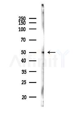 Cytokeratin 18 Antibody - Western blot analysis of lysates from MCF7 cells(heat-shock,45min treatment), using Cytokeratin 18 Antibody at 1/1000 dilution.