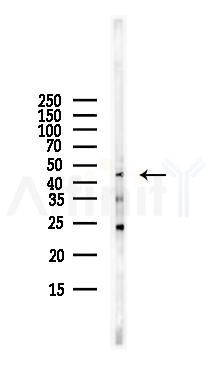MKK7 Antibody - Western blot analysis of lysates from HUVEC cells(starvation,24h treatment), using MKK7 Antibody at 1/1000 dilution.
