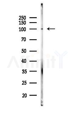 HGS Antibody - Western blot analysis of lysates from EC304 cells(heat-shock,45min treatment), using HGS Antibody at 1/1000 dilution.