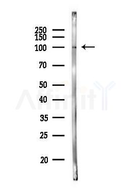 HGS Antibody - Western blot analysis of lysates from MCF7 cells(heat-shock,45min treatment), using HGS Antibody at 1/1000 dilution.