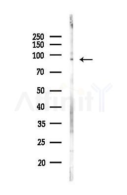 PYGL Antibody - Western blot analysis of lysates from EC304 cells(heat-shock,45min treatment), using PYGL Antibody at 1/1000 dilution.