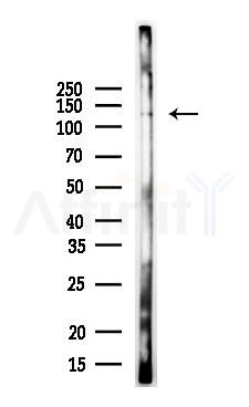 PKD1/PKC mu Antibody - Western blot analysis of lysates from Mouse lung, using PKD1/PKC mu Antibody at 1/1000 dilution.
