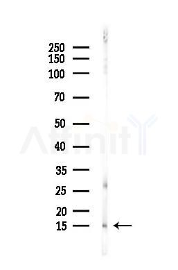 Histone H3 Antibody - Western blot analysis of lysates from EC304 cells(heat-shock,45min treatment), using Histone H3 Antibody at 1/1000 dilution.