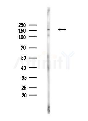 ZO-2 Antibody - Western blot analysis of lysates from HUVEC cells(heat-shock,45min treatment), using ZO-2 Antibody at 1/1000 dilution.