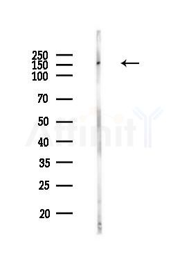 ZO-2 Antibody - Western blot analysis of lysates from MCF7 cells(heat-shock,45min treatment), using ZO-2 Antibody at 1/1000 dilution.