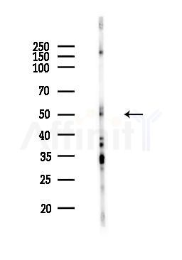 RUNX2 Antibody - Western blot analysis of lysates from MCF7 cells(heat-shock,45min treatment), using RUNX2 Antibody at 1/1000 dilution.