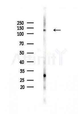 MCM2 Antibody - Western blot analysis of lysates from HUVEC cells(heat-shock,45min treatment), using MCM2 Antibody at 1/1000 dilution.