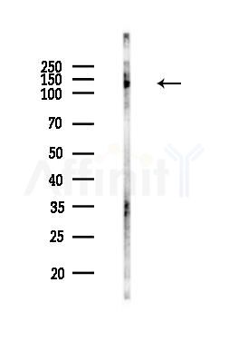 MCM2 Antibody - Western blot analysis of lysates from MCF7 cells(heat-shock,45min treatment), using MCM2 Antibody at 1/1000 dilution.