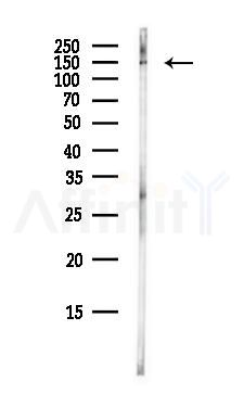 SMC1 Antibody - Western blot analysis of lysates from EC304 cells(heat-shock,45min treatment), using SMC1 Antibody at 1/1000 dilution.