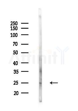 BID Antibody - Western blot analysis of lysates from Mouse brain, using BID Antibody at 1/1000 dilution.