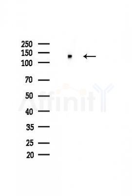 MCM2 Antibody - Western blot analysis of lysates from HUVEC cells(heat-shock,45min treatment), using MCM2 Antibody at 1/1000 dilution.