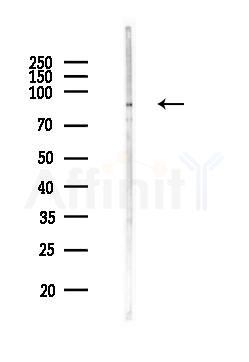 PSD95 Antibody - Western blot analysis of lysates from MCF7 cells(heat-shock,45min treatment), using PSD95 Antibody at 1/1000 dilution.