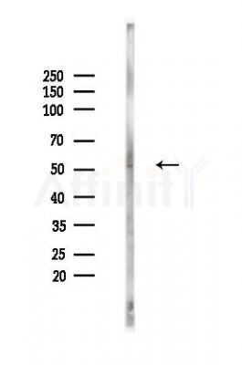 IRF-7 Antibody - Western blot analysis of lysates from HUVEC cells(heat-shock,45min treatment), using IRF-7 Antibody at 1/1000 dilution.
