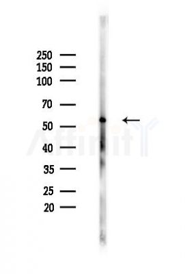 MLKL Antibody - Western blot analysis of lysates from HUVEC cells(heat-shock,45min treatment), using MLKL Antibody at 1/1000 dilution.