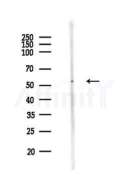 MLKL Antibody - Western blot analysis of lysates from MCF7 cells(heat-shock,45min treatment), using MLKL Antibody at 1/1000 dilution.