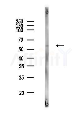 MLKL Antibody - Western blot analysis of lysates from PC12 cells, using MLKL Antibody at 1/1000 dilution.