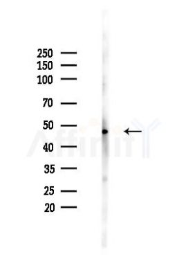 MLKL Antibody - Western blot analysis of lysates from HUVEC cells(heat-shock,45min treatment), using MLKL Antibody at 1/1000 dilution.