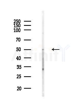 MLKL Antibody - Western blot analysis of lysates from MCF7 cells(heat-shock,45min treatment), using MLKL Antibody at 1/1000 dilution.