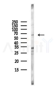 CRMP2 Antibody - Western blot analysis of lysates from HUVEC cells(starvation,24h treatment), using CRMP2 Antibody at 1/1000 dilution.