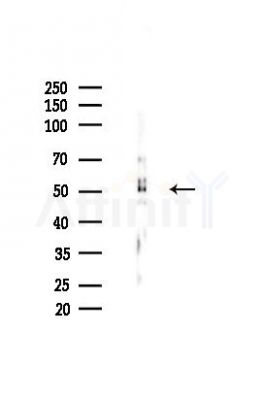 Pim-1 Antibody - Western blot analysis of lysates from HUVEC cells(heat-shock,45min treatment), using Pim-1 Antibody at 1/1000 dilution.