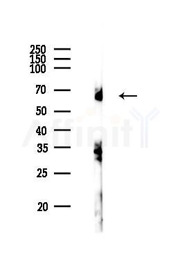 Paxillin Antibody - Western blot analysis of lysates from PC12 cells, using Paxillin Antibody at 1/1000 dilution.