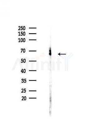 Paxillin Antibody - Western blot analysis of lysates from HUVEC cells(heat-shock,45min treatment), using Paxillin Antibody at 1/1000 dilution.
