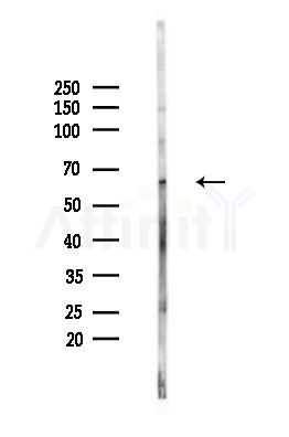 PLK1 Antibody - Western blot analysis of lysates from HUVEC cells(heat-shock,45min treatment), using PLK1 Antibody at 1/1000 dilution.