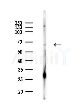 PLK1 Antibody - Western blot analysis of lysates from MCF7 cells(heat-shock,45min treatment), using PLK1 Antibody at 1/1000 dilution.
