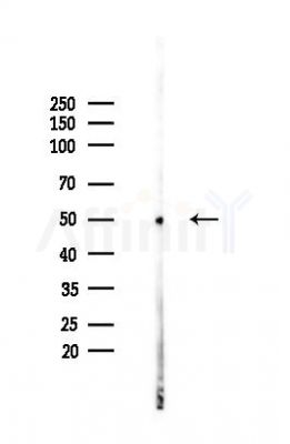 TUBB3 Antibody - Western blot analysis of lysates from HUVEC cells(heat-shock,45min treatment), using TUBB3 Antibody at 1/1000 dilution.