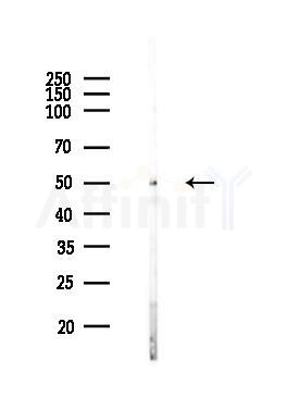 TUBB3 Antibody - Western blot analysis of lysates from MCF7 cells(heat-shock,45min treatment), using TUBB3 Antibody at 1/1000 dilution.