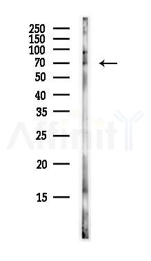 Cox2 Antibody - Western blot analysis of lysates from EC304 cells(heat-shock,45min treatment), using Cox2 Antibody at 1/1000 dilution.