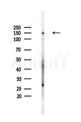 HDAC9 Antibody - Western blot analysis of lysates from HUVEC cells(heat-shock,45min treatment), using HDAC9 Antibody at 1/1000 dilution.