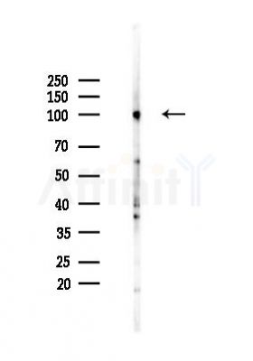 Nrf2 Antibody - Western blot analysis of lysates from HUVEC cells(heat-shock,45min treatment), using Nrf2 Antibody at 1/1000 dilution.