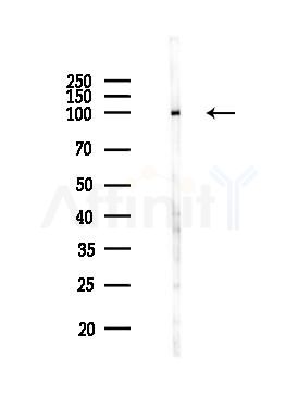 Nrf2 Antibody - Western blot analysis of lysates from MCF7 cells(heat-shock,45min treatment), using Nrf2 Antibody at 1/1000 dilution.