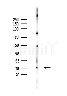 TIMP4 Antibody - Western blot analysis of lysates from HUVEC cells(heat-shock,45min treatment), using TIMP4 Antibody at 1/1000 dilution.