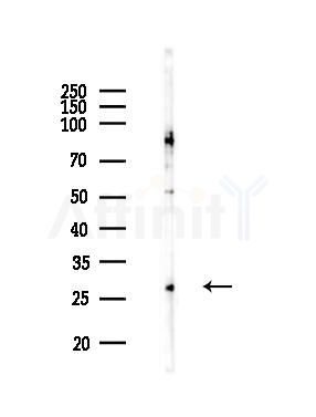 TIMP4 Antibody - Western blot analysis of lysates from MCF7 cells(heat-shock,45min treatment), using TIMP4 Antibody at 1/1000 dilution.