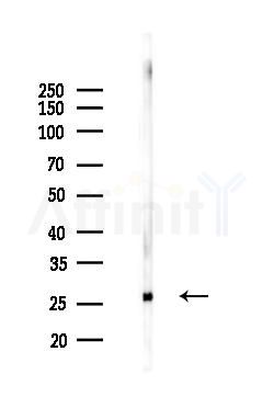 TIMP4 Antibody - Western blot analysis of lysates from Mouse brain, using TIMP4 Antibody at 1/1000 dilution.