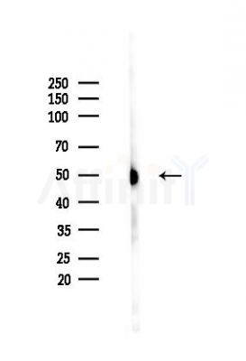 Tubulin alpha Antibody - Western blot analysis of lysates from HUVEC cells(heat-shock,45min treatment), using Tubulin alpha Antibody at 1/1000 dilution.