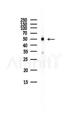 Tubulin alpha Antibody - Western blot analysis of lysates from HepG2 cells(LPS, 4h treatment), using Tubulin alpha Antibody at 1/1000 dilution.