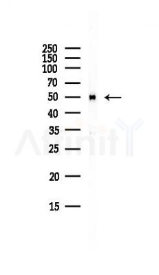 Tubulin alpha Antibody - Western blot analysis of lysates from HepG2 cells(LPS, 4h treatment), using Tubulin alpha Antibody at 1/1000 dilution.