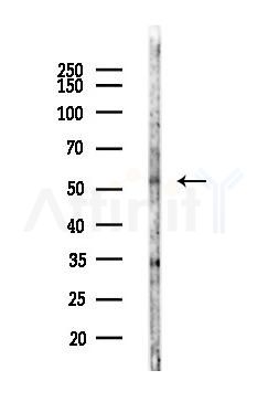 Tubulin beta Antibody - Western blot analysis of lysates from LoVo cells(heat-shock,45min treatment), using Tubulin beta Antibody at 1/1000 dilution.