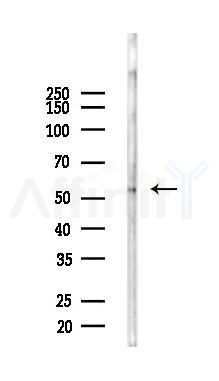 Tubulin beta Antibody - Western blot analysis of lysates from COLO205 cells(LPS,4h treatment), using Tubulin beta Antibody at 1/1000 dilution.