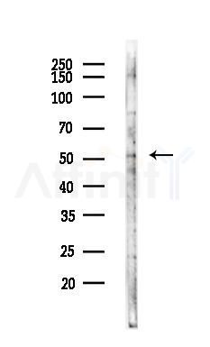 Tubulin gamma Antibody - Western blot analysis of lysates from LoVo cells(heat-shock,45min treatment), using Tubulin gamma Antibody at 1/1000 dilution.