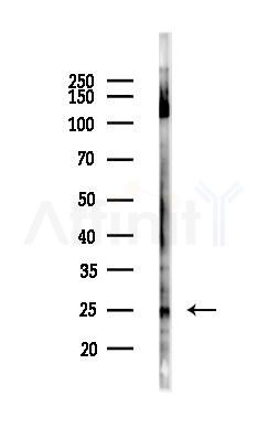 TNF alpha Antibody - Western blot analysis of lysates from Mouse liver, using TNF alpha Antibody at 1/1000 dilution.